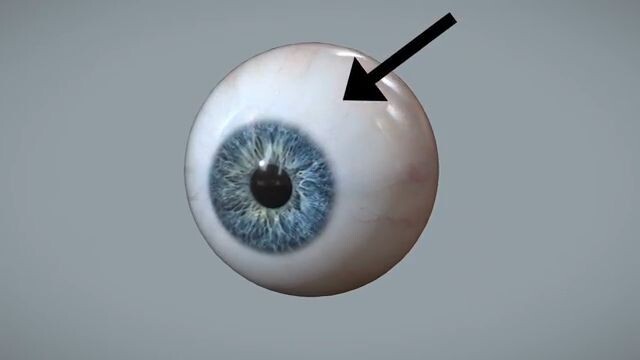 A detailed report on human's Eye !