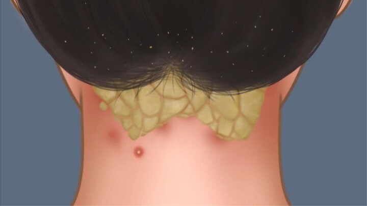 High-energy decompression: Miss and sister grow mites on her head, immersive beauty repair, the proc