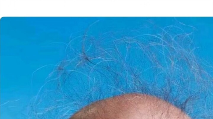 What’s the most shocking “haircut” you’ve ever seen?