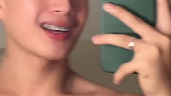 😲