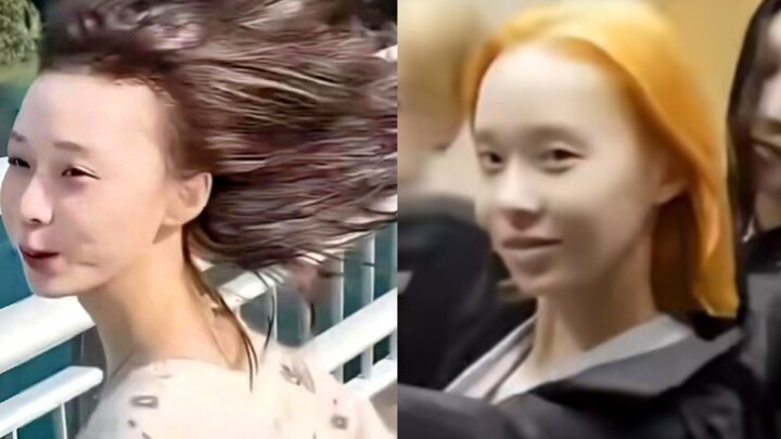 Kim Min-jeong: Hyaluronic acid forehead injections have left people utterly bewildered.
