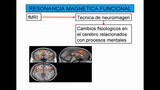 Las diferencias entre resonancia magnética hospitalaria y resonancia magnética f