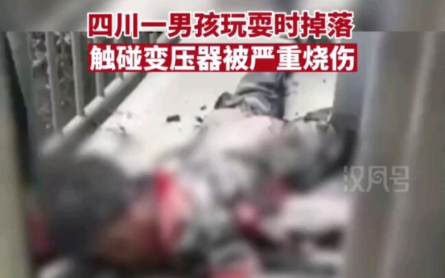 Một cậu bé ở huyện Cừ, Tứ Xuyên vô tình rơi xuống trong lúc chơi đùa và chạm vào máy biến áp, bị bỏn