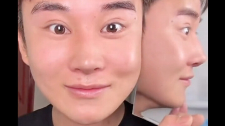 Hidung buatan ibu Qin Xinyu akhirnya kembali, tenaga medis: Dia… menakuti… dirinya sendiri～