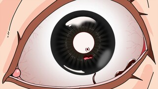 What to do if a leech gets stuck in your eyes