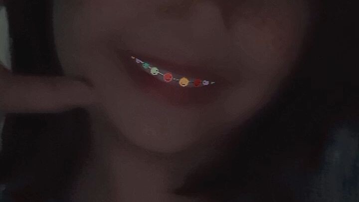 edit