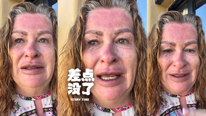 Be extremely careful at the beach‼️