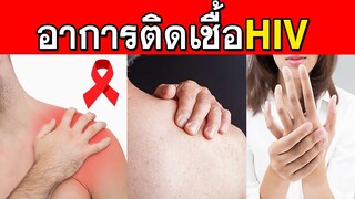 จะรู้ได้ไงว่าติดเชื้อ HIV ............อาการคนติดเอดส์ (ลองสังเกตุตามนี้)