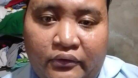 Di po Ako Nakakalakad