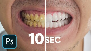Photoshop Tutorial Shorts: How To Whiten Teeth In Photoshop #shorts #viral #tech #Photoshop #Remove