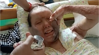 Chỉ mới nhỏ tuổi mà đã bị bỏng bất ngờ, may mà cháu bé rất lạc quan.