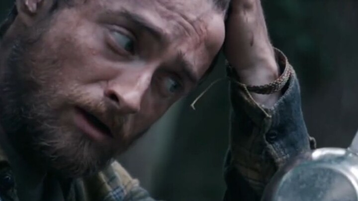 Man trapped in the jungle develops a huge lump on his head—surprisingly, it moves when touched! He’s