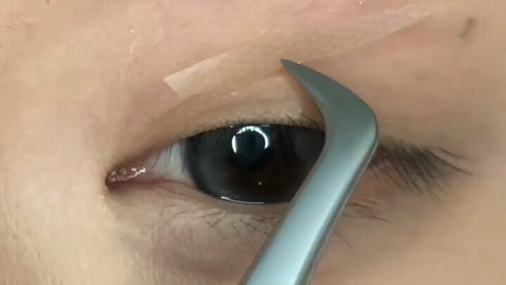 Who still doesn’t know how to apply double-eye stickers? A lifesaver for beginners with epicanthic f