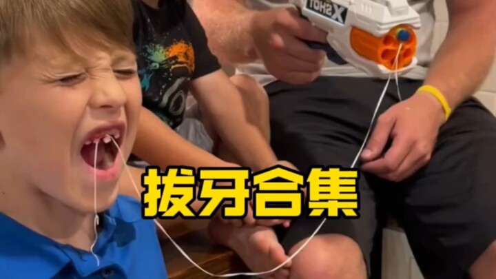 Tập hợp nhổ răng