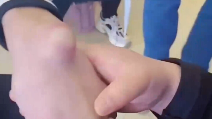 القضاء على كيس الجراب في ثوانٍ