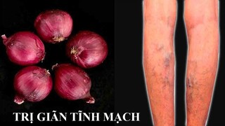 TRỊ DỨT ĐIỂM SUY GIÃN TĨNH MẠCH, HUYẾT ÁP CAO - Verabschieden Sie sich für immer von Krampfadern