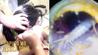 29-anyos, napasukan ng insektong may galamay sa tenga habang natutulog!  | Kapuso Mo, Jessica Soho
