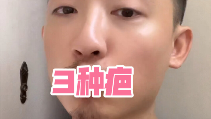 这个世界上有3种疤