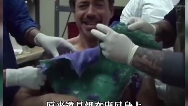 Robert Downey Jr.’s chest hole is actually real! But the leg resting on the chair is fake?