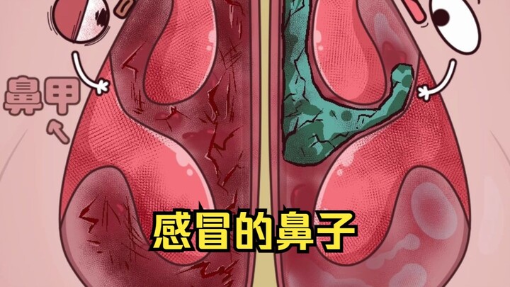 What happens when a rotational intern gets a nose cold?