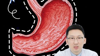 Why does stomach cancer target Asians?
