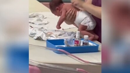 Điều dưỡng: Rất đơn giản, giống như rửa củ cải vậy