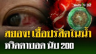 ลูกบ้านคอนโดหรู ติดเชื้อปรสิตเกือบ 200 คน หวิดตาบอด | 9 ก.ค. 67 | ไทยรัฐนิวส์โชว์