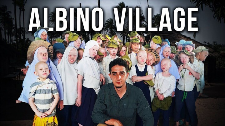 Visiting the Secret Albino Village in Tanzania (Too White to Live)