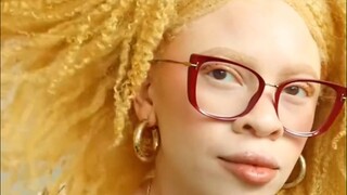 The black girl with albinism has a head full of golden curly hair. Watching her wash her hair, there