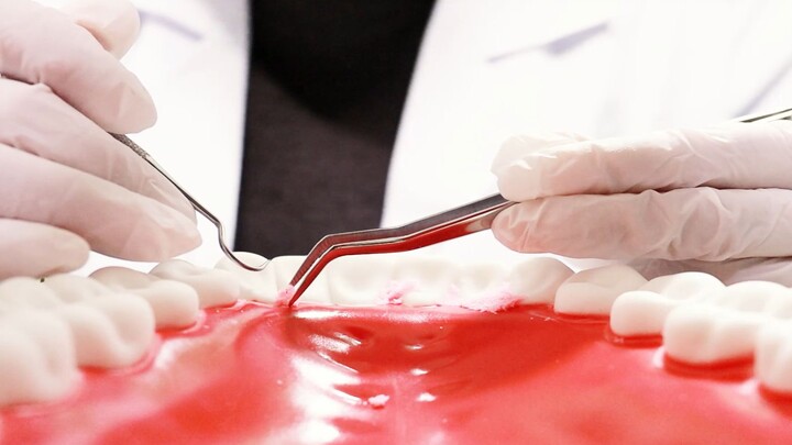 [Sleep Aid] A gentle young lady helps you check your teeth—removes food debris + chats softly