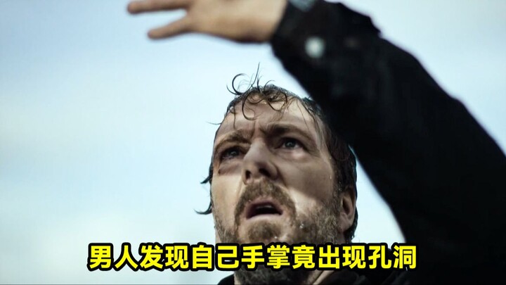 Người đàn ông phát hiện trên lòng bàn tay mình bỗng xuất hiện một lỗ hổng kỳ lạ.