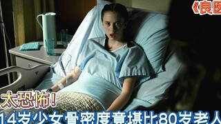 14岁女孩为减肥长期食用魔芋面，骨密度竟和80岁老人一样！《良医第4季：08》