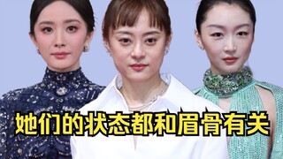 Their condition is related to the brow bone