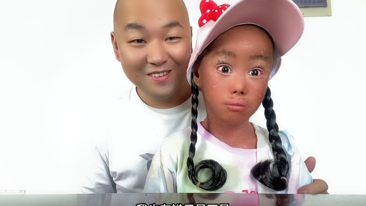 Kepalaku gatal, jadi Ayah cukur habis rambutku. Setelah selesai potong rambut, Ayah kasih aku topi d