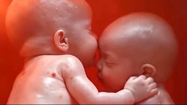 Twins baby inside the womb
