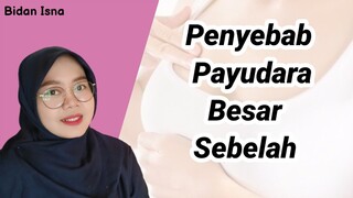 PAYUDARA BESAR SEBELAH, APA PENYEBABNYA, APAKAH BERBAHAYA BIDAN ISNA