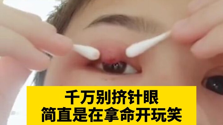 [Science Tip] Don’t squeeze a stye! The veins around the eye lack venous valves. Rubbing or squeezin