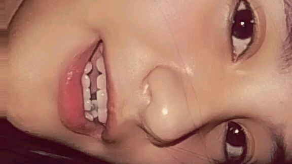 🫀