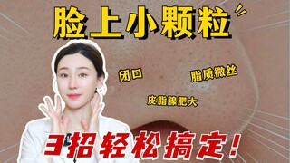 Various tiny bumps on your face? Here's a guide to help you deal with them!