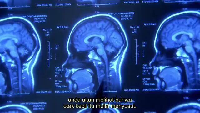 1 litre of tears ep 2