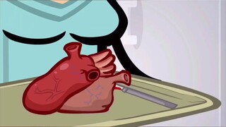 Transplantasi jantung