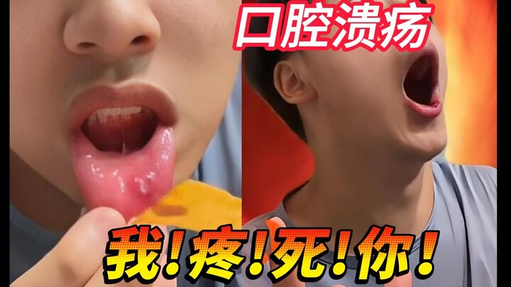 Tôi tuyên bố: Đây là vị thần cổ đại Hy Lạp chuyên trị loét miệng!