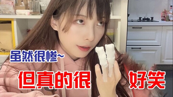 Nói ra chính tôi còn không dám tin! Tôi bị cửa kẹp chỉ vì làm món thịt kho tàu! Tuy bi đát thật đấy 