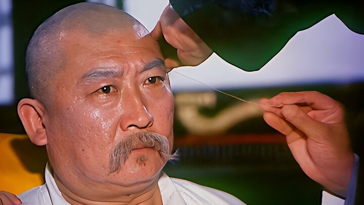 Yuan Shikai sakit kepala hebat hingga nyaris pecah, bahkan dokter Barat pun tak mampu menolongnya. N