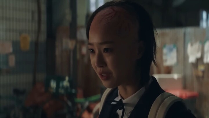 A Girl with Burned Face goes to a New School and Takes Revenge on the Bullies th