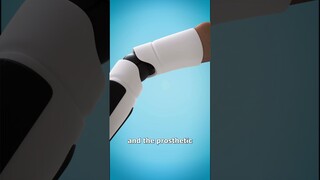 How A Bionic Arm Works 🤔