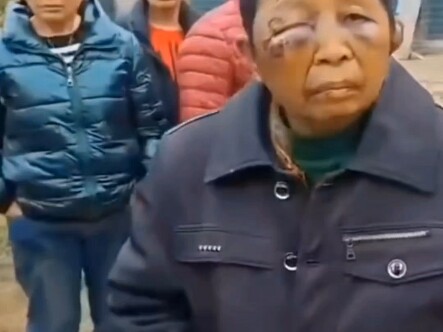 العجوز يتعرض للعنف المنزلي لفترة طويلة.. انتفضوا ضد العنف الأسري!