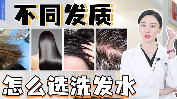Berminyak? Kering? Normal? Bagaimana memilih sampo sesuai dengan jenis rambut yang berbeda?