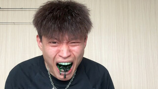 การหายไปของกระเพาะอาหาร