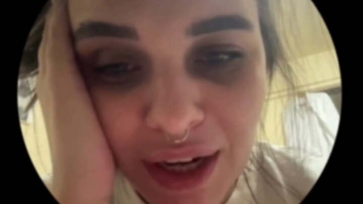 Dogmen somehow opened my vitamin jar with 240 capsules—and ate them all, leaving only about half rem